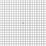 Amsler-Grid