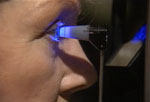 Laser Trabeculoplasty
