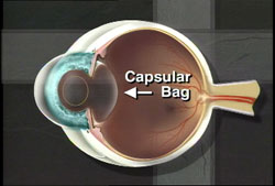 diagram of a cross section of an eye showing the location of the capsular bag or lens of the eye