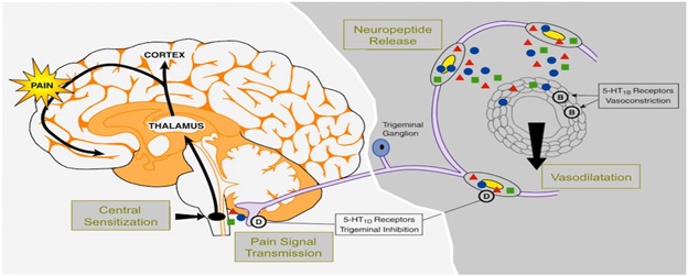 Pathophysiology of Migraine