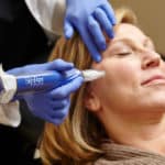 SkinPen